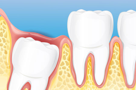 Oral Surgery